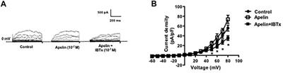 Apelin Does Not Impair Coronary Artery Relaxation Mediated by Nitric Oxide-Induced Activation of BKCa Channels